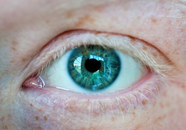 Alternativa em tratamento de pálpebra caída sem cirurgia